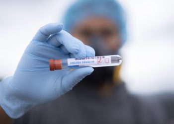 Koronavirus, näyte, laboratorio