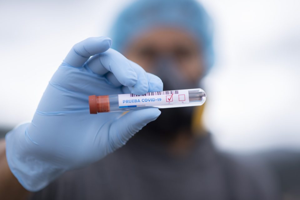 Koronavirus, näyte, laboratorio
